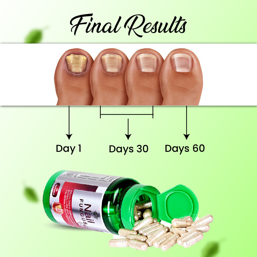 Nail Fungus Capsule 60's