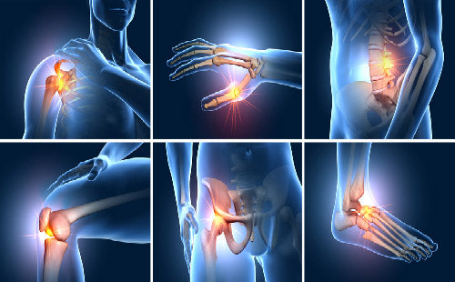 all_types_joint_pain