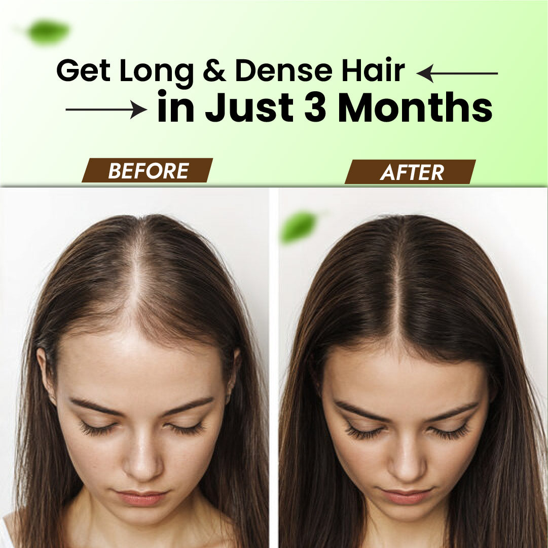 Roghan-e-Amla 100 ML